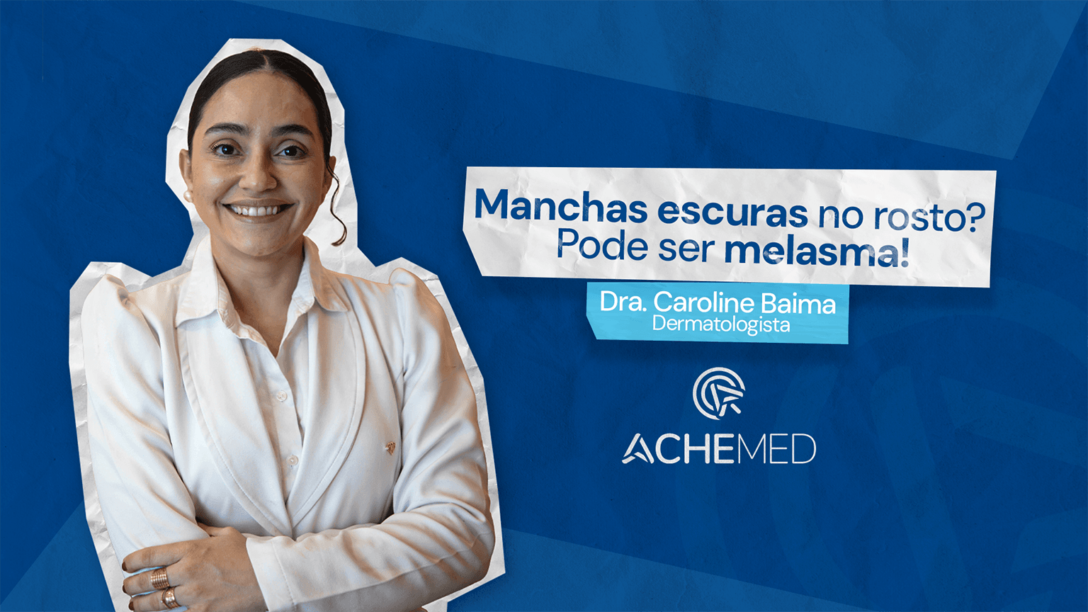 Manchas escuras o rosto? Pode ser melasma!